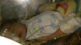 Lintang, bayi yang lahir tanpa anus hingga kini masih membutuhkan bantuan untuk perawatan intensif di RS Fatmawati, Jakrta (dok. KM)