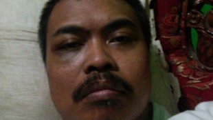 Iik, wartawan yang dikeroyok oleh oknum buser Polresta Depok, memperlihatkan matanya yang lebam (dok. KM)