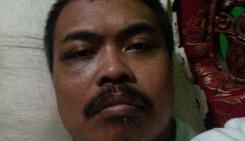 Iik, wartawan yang dikeroyok oleh oknum buser Polresta Depok, memperlihatkan matanya yang lebam (dok. KM)