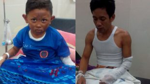 Usup (kanan) dan anaknya, korban ledakan akibat kebocoran gas LPG (dok. KM)