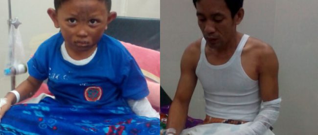 Usup (kanan) dan anaknya, korban ledakan akibat kebocoran gas LPG (dok. KM)