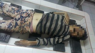 Wanita tua yang ditemukan warga Cibogor dalam keadaan sekarat, meninggal dunia di jalan menuru RS Bhayangkara, Kota Bogor (dok. KM)