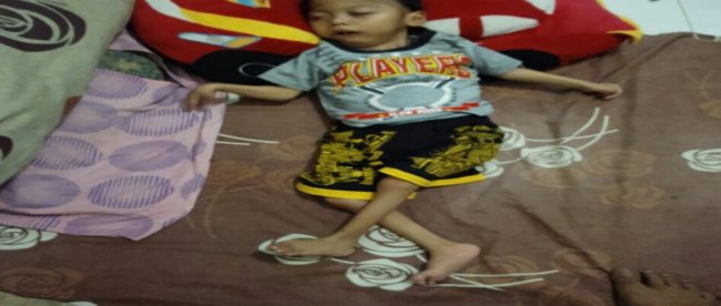 Dika, bocah penderita gizi buruk di Desa Cibanteng, Kecamtan Ciampea, Bogor (dok. kM)