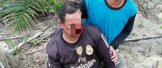 Kondisi Samsuli yang di tolong oleh Subir di lokasi TKP (dok. KM)