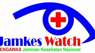 Jamkes Watch (stock)