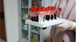 Pemprov DKI Jakarta melakukan rapid test covid-19 menggunakan dengan serum dengan menyasar warga yang berisiko tibggi tertular (dok. KM)
