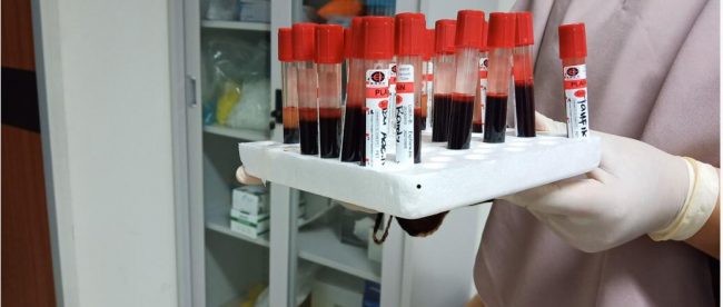 Pemprov DKI Jakarta melakukan rapid test covid-19 menggunakan dengan serum dengan menyasar warga yang berisiko tibggi tertular (dok. KM)
