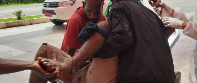 Warga mengevakuasi korban penganiayaan di Kecamatan Kadung Jaya, Mimika, Papua (dok. KM)