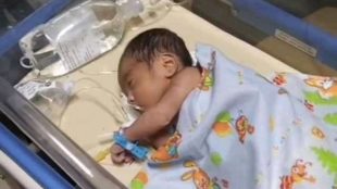 foto: M.Raihan Alfatih, Bayi lahir tanpa memiliki Anus